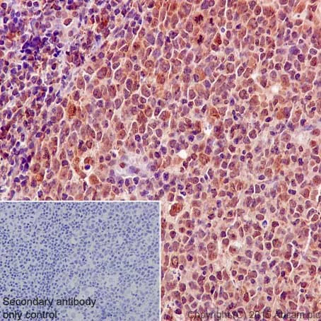 Immunohistochemistry (Formalin/PFA-fixed paraffin-embedded sections) - Anti-Bcl2-L-13 antibody [EP10625] - BSA and Azide free (AB251397)
