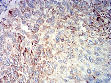 Immunohistochemistry (Formalin/PFA-fixed paraffin-embedded sections) - Anti-BCL2L10 antibody [8A2F9] (AB233641)