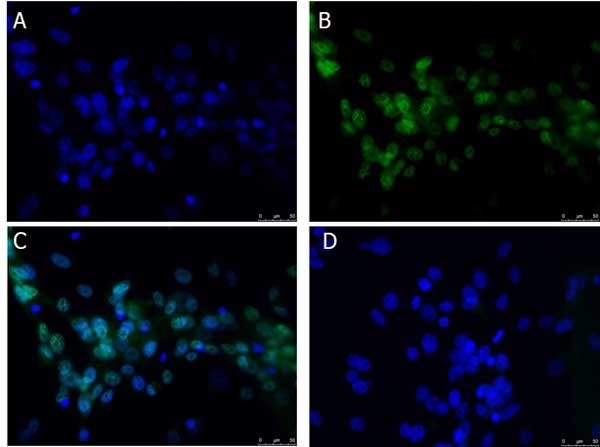 Immunocytochemistry/ Immunofluorescence - Anti-Bcl3 antibody (AB216877)
