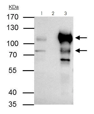 Immunoprecipitation - Anti-Bcl6 antibody (AB272859)
