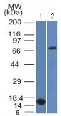 Western blot - Anti-Bcl6 antibody [BCL6/1475] (AB218507), expandable thumbnail