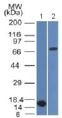 Western blot - Anti-Bcl6 antibody [BCL6/1475] (AB218507)