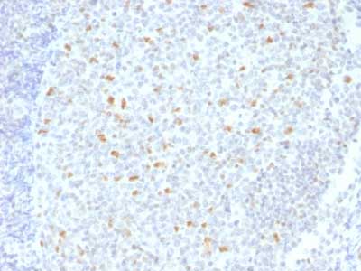 Immunohistochemistry (Formalin/PFA-fixed paraffin-embedded sections) - Anti-Bcl6 antibody [BCL6/1526] - BSA and Azide free (AB218951), expandable thumbnail