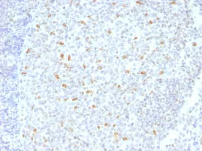 Immunohistochemistry (Formalin/PFA-fixed paraffin-embedded sections) - Anti-Bcl6 antibody [BCL6/1526] - BSA and Azide free (AB218951)