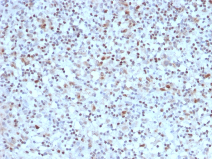 Immunohistochemistry (Formalin/PFA-fixed paraffin-embedded sections) - Anti-Bcl6 antibody [BCL6/1527] (AB218509)