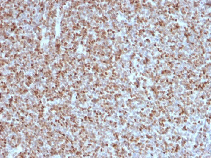 Immunohistochemistry (Formalin/PFA-fixed paraffin-embedded sections) - Anti-Bcl6 antibody [BCL6/1527] (AB218509)