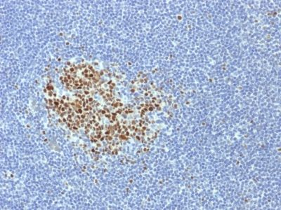 Immunohistochemistry (Formalin/PFA-fixed paraffin-embedded sections) - Anti-Bcl6 antibody [BCL6/1718] (AB238045)