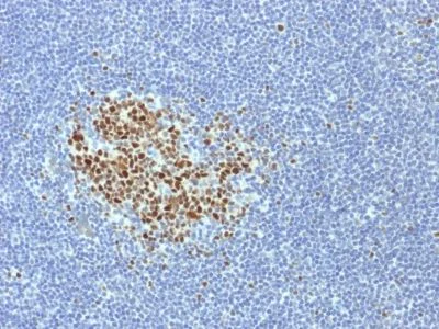 Immunohistochemistry (Formalin/PFA-fixed paraffin-embedded sections) - Anti-Bcl6 antibody [BCL6/1718] (AB238045)