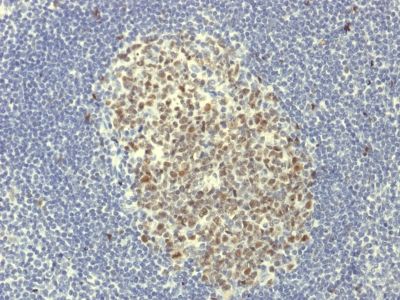 Immunohistochemistry (Formalin/PFA-fixed paraffin-embedded sections) - Anti-Bcl6 antibody [BCL6/1951R] (AB238046)