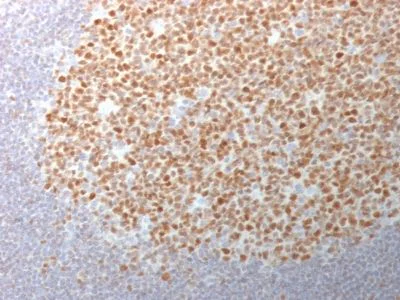 Immunohistochemistry (Formalin/PFA-fixed paraffin-embedded sections) - Anti-Bcl6 antibody [BCL6/1982] (AB238044)