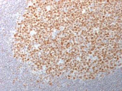 Immunohistochemistry (Formalin/PFA-fixed paraffin-embedded sections) - Anti-Bcl6 antibody [BCL6/1982] - BSA and Azide free (AB237894), expandable thumbnail