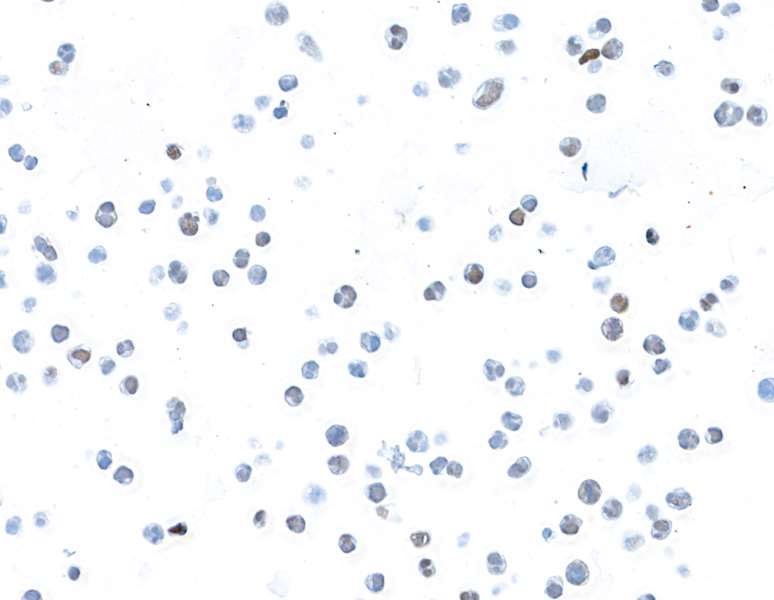 Immunocytochemistry - Anti-Bcl6 antibody [BLR143H] - BSA free (AB314099), expandable thumbnail