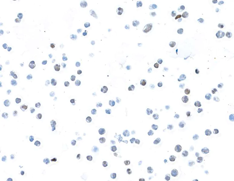Immunocytochemistry - Anti-Bcl6 antibody [BLR143H] - BSA free (AB314099)