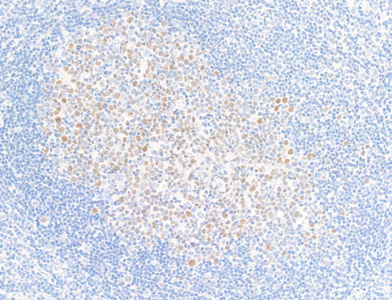 Immunohistochemistry (Formalin/PFA-fixed paraffin-embedded sections) - Anti-Bcl6 antibody [BLR143H] - BSA free (AB314099), expandable thumbnail