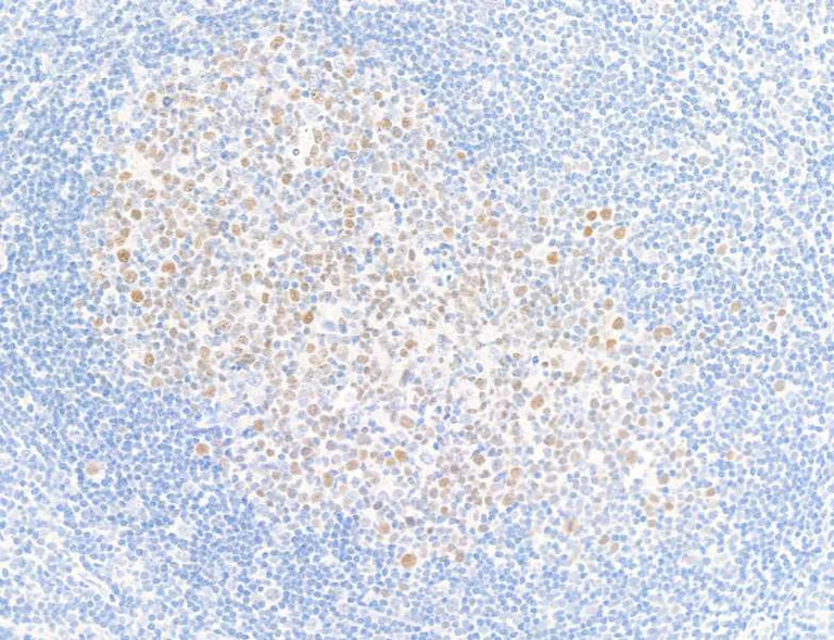 Immunohistochemistry (Formalin/PFA-fixed paraffin-embedded sections) - Anti-Bcl6 antibody [BLR143H] - BSA free (AB314099)