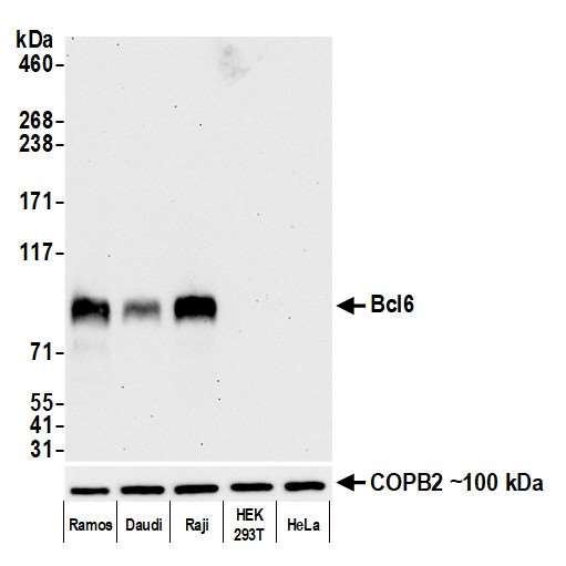 Western blot - Anti-Bcl6 antibody [BLR143H] - BSA free (AB314099), expandable thumbnail
