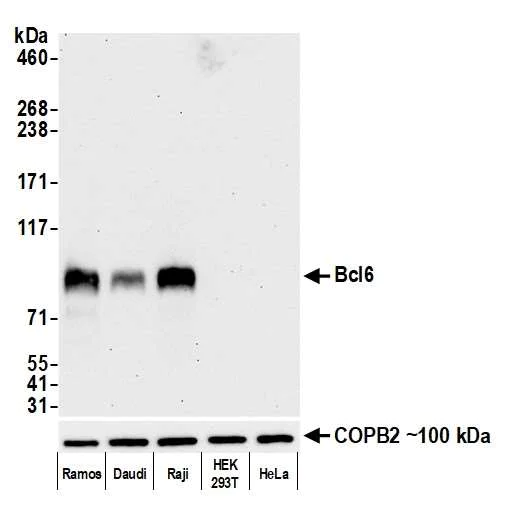 Western blot - Anti-Bcl6 antibody [BLR143H] - BSA free (AB314099)