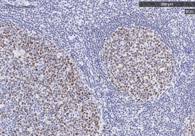 Immunohistochemistry (Formalin/PFA-fixed paraffin-embedded sections) - Anti-Bcl6 antibody [EPR11410-43] (AB172610), expandable thumbnail