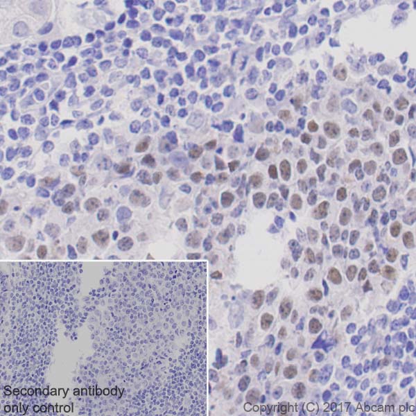 Immunohistochemistry (Formalin/PFA-fixed paraffin-embedded sections) - Anti-Bcl6 antibody [EPR11410-43] (AB172610), expandable thumbnail