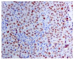 Immunohistochemistry (Formalin/PFA-fixed paraffin-embedded sections) - Anti-Bcl6 antibody [EPR11410-43] (ab172610), expandable thumbnail