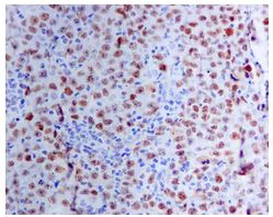 Immunohistochemistry (Formalin/PFA-fixed paraffin-embedded sections) - Anti-Bcl6 antibody [EPR11410-43] (AB172610)