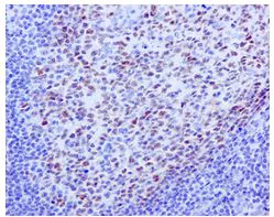 Immunohistochemistry (Formalin/PFA-fixed paraffin-embedded sections) - Anti-Bcl6 antibody [EPR11410-43] - BSA and Azide free (AB249707)