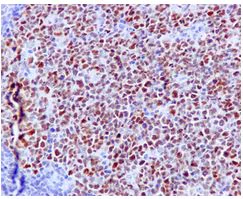 Immunohistochemistry (Formalin/PFA-fixed paraffin-embedded sections) - Anti-Bcl6 antibody [EPR11410-43] - BSA and Azide free (AB249707)