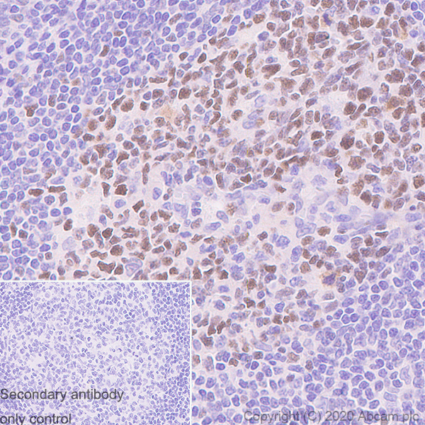 Immunohistochemistry (Formalin/PFA-fixed paraffin-embedded sections) - Anti-Bcl6 antibody [GI191E] - BSA and Azide free (AB252801), expandable thumbnail