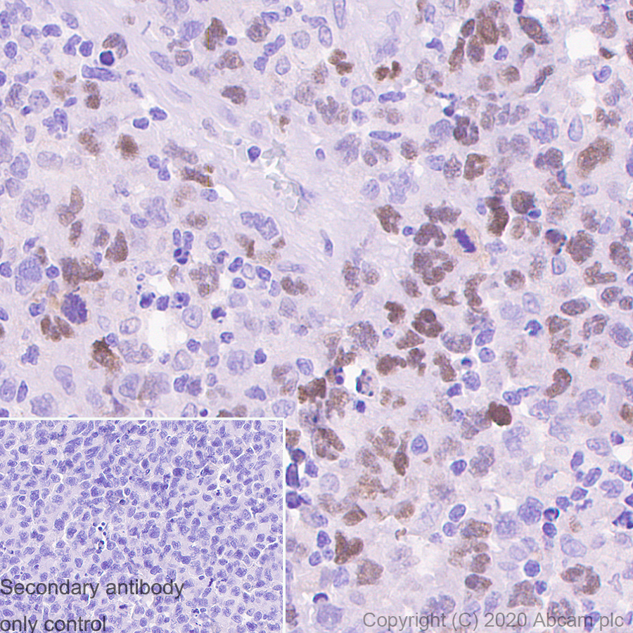Immunohistochemistry (Formalin/PFA-fixed paraffin-embedded sections) - Anti-Bcl6 antibody [GI191E] - BSA and Azide free (ab252801), expandable thumbnail