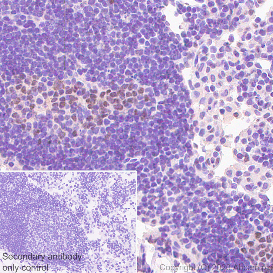 Immunohistochemistry (Formalin/PFA-fixed paraffin-embedded sections) - Anti-Bcl6 antibody [GI191E] - BSA and Azide free (ab252801), expandable thumbnail