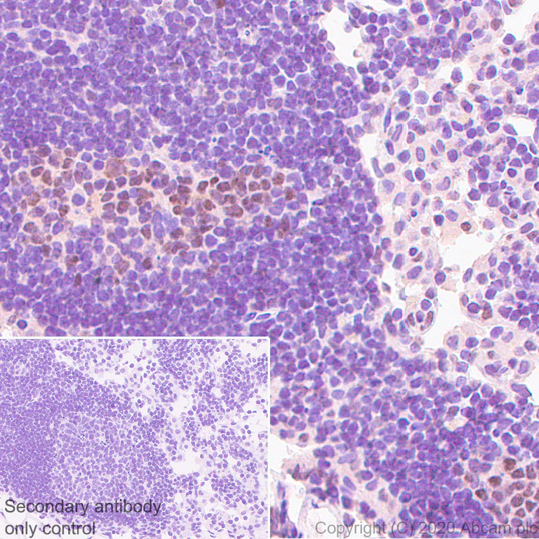 Immunohistochemistry (Formalin/PFA-fixed paraffin-embedded sections) - Anti-Bcl6 antibody [GI191E] - BSA and Azide free (AB252801)