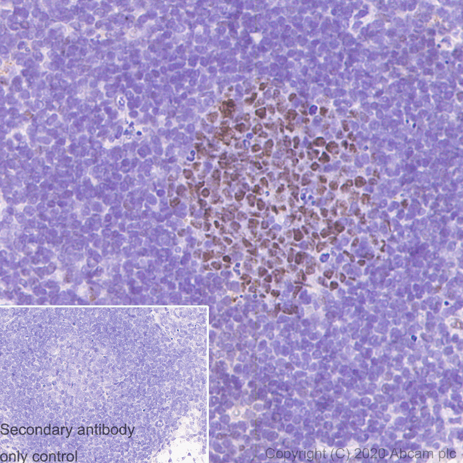 Immunohistochemistry (Formalin/PFA-fixed paraffin-embedded sections) - Anti-Bcl6 antibody [GI191E] - BSA and Azide free (AB252801), expandable thumbnail