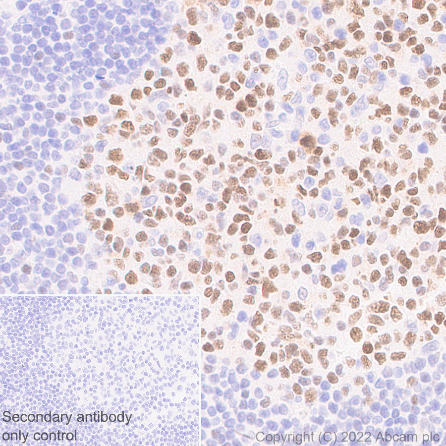 Immunohistochemistry (Formalin/PFA-fixed paraffin-embedded sections) - Anti-Bcl6 antibody [K112-91] (AB307681)