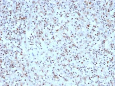 Immunohistochemistry (Formalin/PFA-fixed paraffin-embedded sections) - Anti-Bcl6 antibody [rBCL6/1527] - BSA and Azide free (AB237893)