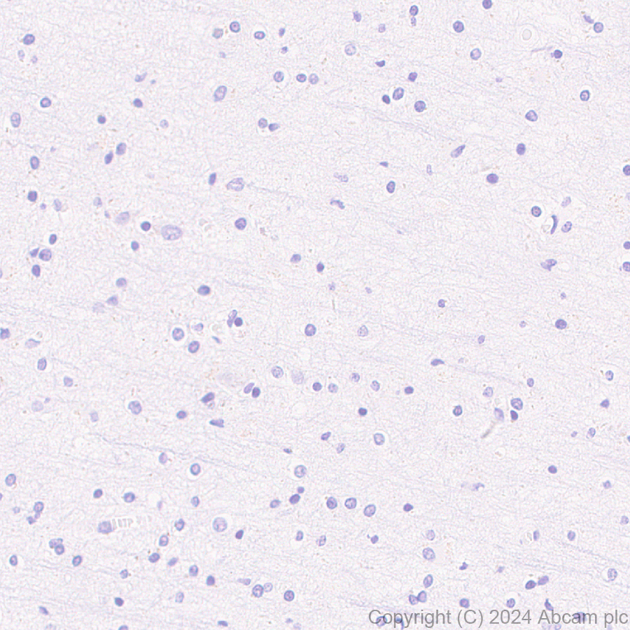Immunohistochemistry (Formalin/PFA-fixed paraffin-embedded sections) - Anti-Bcl6 antibody [RM1183] (AB317337), expandable thumbnail