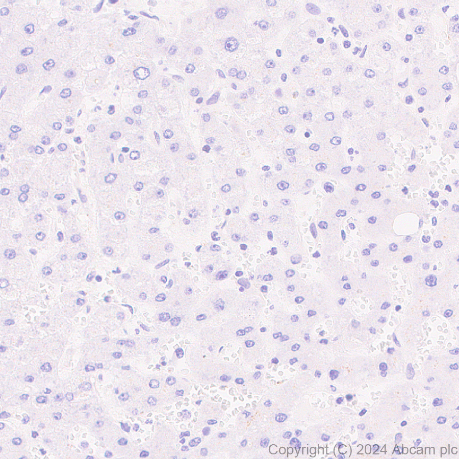 Immunohistochemistry (Formalin/PFA-fixed paraffin-embedded sections) - Anti-Bcl6 antibody [RM1183] (AB317337), expandable thumbnail