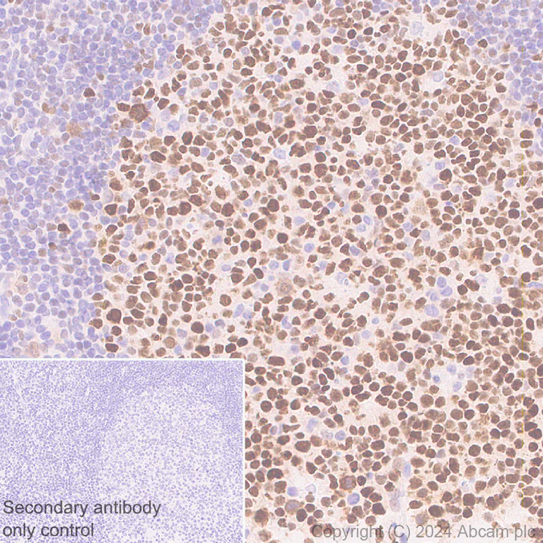 Immunohistochemistry (Formalin/PFA-fixed paraffin-embedded sections) - Anti-Bcl6 antibody [RM1183] - BSA and Azide free (AB317338)