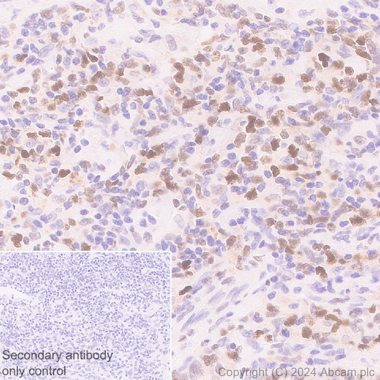 Immunohistochemistry (Formalin/PFA-fixed paraffin-embedded sections) - Anti-Bcl6 antibody [RM1183] - BSA and Azide free (AB317338)