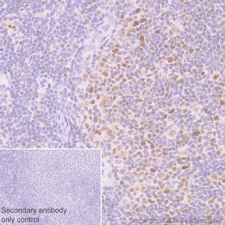 Immunohistochemistry (Formalin/PFA-fixed paraffin-embedded sections) - Anti-Bcl6 antibody [RM1183] - BSA and Azide free (AB317338)