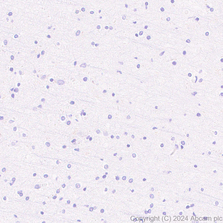 Immunohistochemistry (Formalin/PFA-fixed paraffin-embedded sections) - Anti-Bcl6 antibody [RM1183] - BSA and Azide free (AB317338)