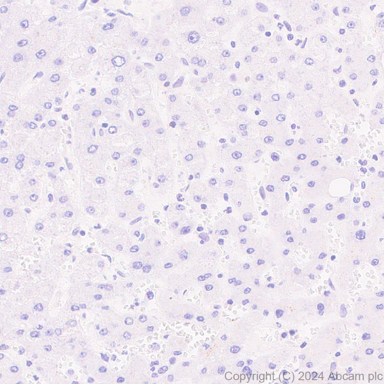 Immunohistochemistry (Formalin/PFA-fixed paraffin-embedded sections) - Anti-Bcl6 antibody [RM1183] - BSA and Azide free (AB317338)