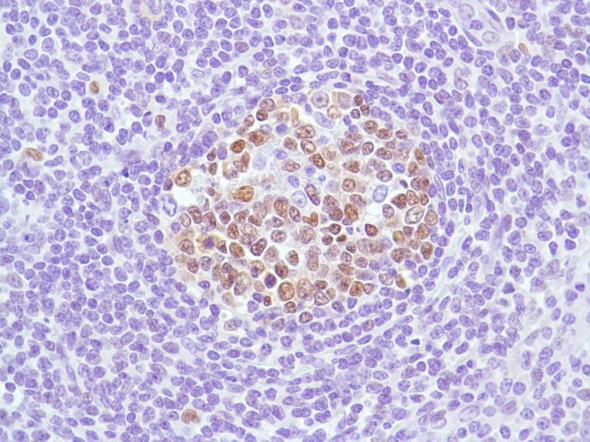 Immunohistochemistry (Formalin/PFA-fixed paraffin-embedded sections) - Anti-Bcl6 antibody [SP155] - BSA and Azide free (ab243920), expandable thumbnail