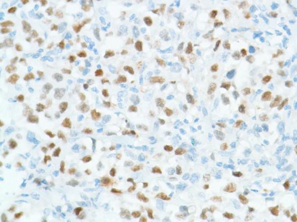 Immunohistochemistry (Formalin/PFA-fixed paraffin-embedded sections) - Anti-Bcl6 antibody [SP155] - BSA and Azide free (AB243920), expandable thumbnail
