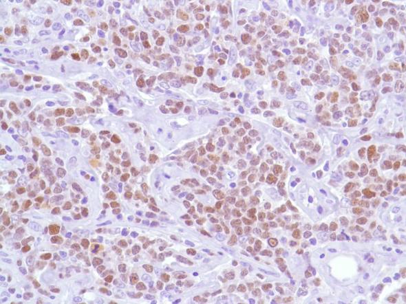 Immunohistochemistry (Formalin/PFA-fixed paraffin-embedded sections) - Anti-Bcl6 antibody [SP155] - BSA and Azide free (ab243920), expandable thumbnail