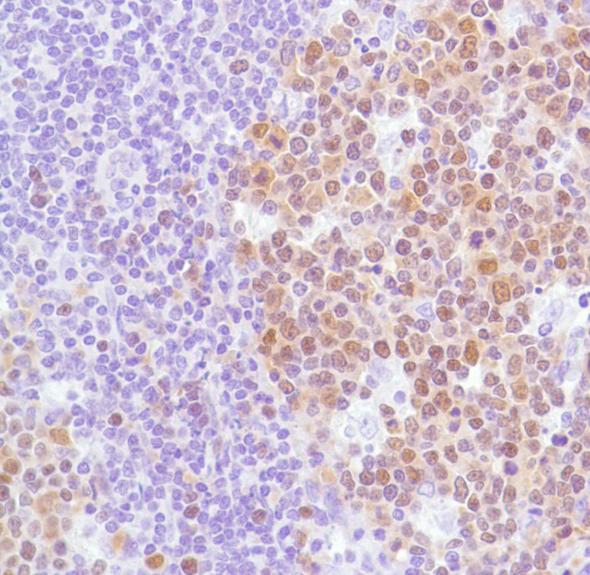 Immunohistochemistry (Formalin/PFA-fixed paraffin-embedded sections) - Anti-Bcl6 antibody [SP155] - BSA and Azide free (ab243920), expandable thumbnail