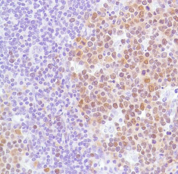 Immunohistochemistry (Formalin/PFA-fixed paraffin-embedded sections) - Anti-Bcl6 antibody [SP155] - BSA and Azide free (AB243920)