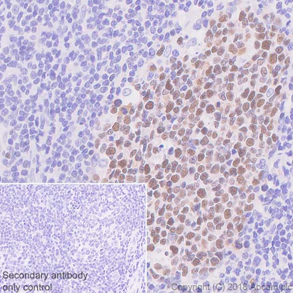 Immunohistochemistry (Formalin/PFA-fixed paraffin-embedded sections) - Anti-Bcl6 antibody [SP155] - BSA and Azide free (AB243920), expandable thumbnail