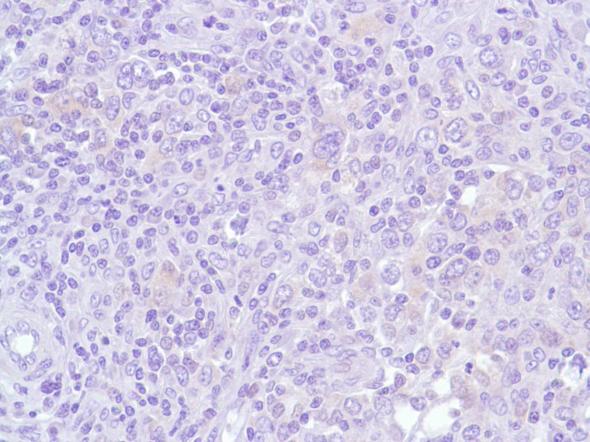 Immunohistochemistry (Formalin/PFA-fixed paraffin-embedded sections) - Anti-Bcl6 antibody [SP155] - BSA and Azide free (AB243920), expandable thumbnail