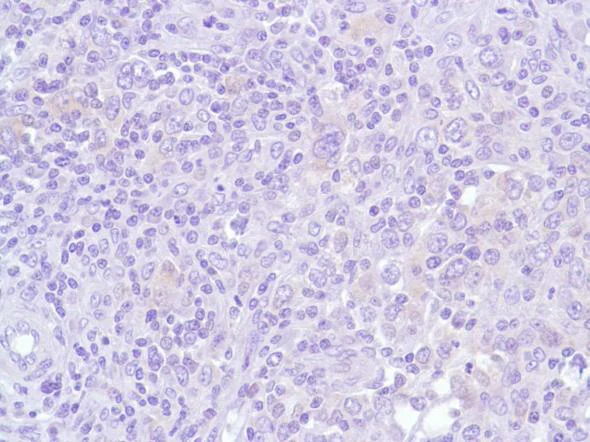 Immunohistochemistry (Formalin/PFA-fixed paraffin-embedded sections) - Anti-Bcl6 antibody [SP155] - BSA and Azide free (AB243920)