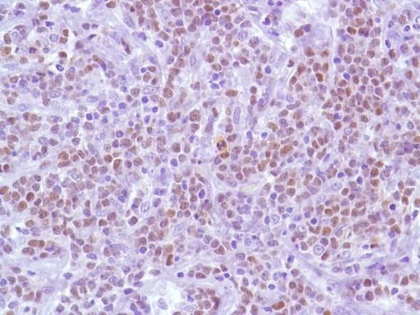 Immunohistochemistry (Formalin/PFA-fixed paraffin-embedded sections) - Anti-Bcl6 antibody [SP155] - C-terminal (AB183308)